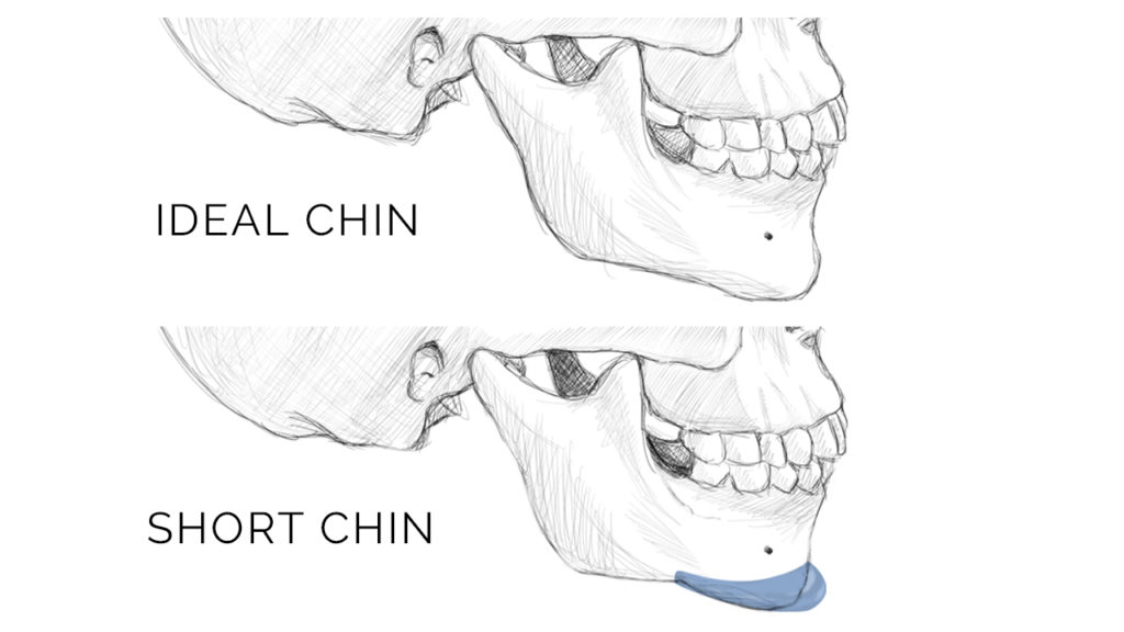 08-SkullChinSideBySide