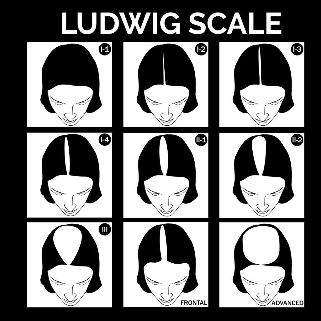 Ludwig